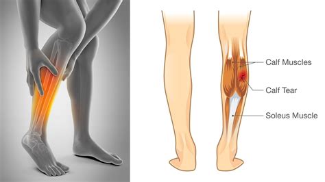anatomical term   calf muscle    leg
