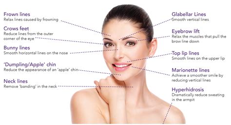 Botox Facial Areas Women S Ob Gyn Center