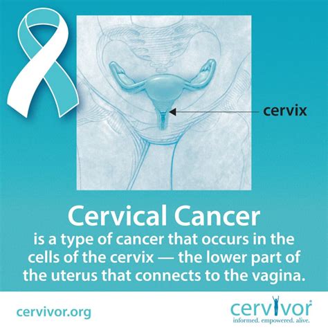 cervical cancer prevention cervivor