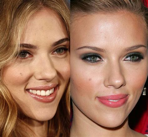 Scarlett Johansson Plastic Surgery Before And After Nose