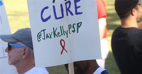 Estimates Of People Living With Hiv Aids In Riverside County Were