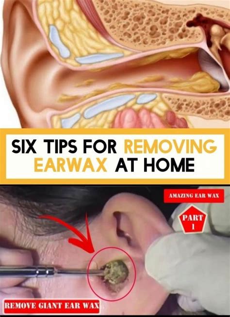 tips  earwax removal   ear wax natural lubricant tips