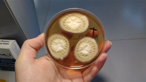 trichophyton rubrum front sabouraud plate microbiology lab plates