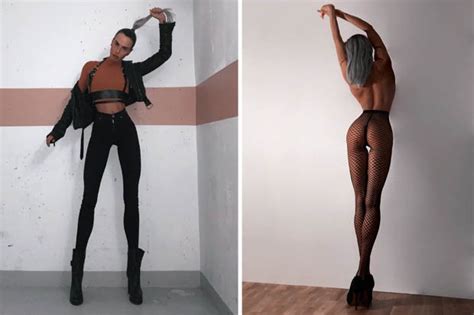 Model Showcases 40 Inch Legs But Says She Was Bullied At School Over