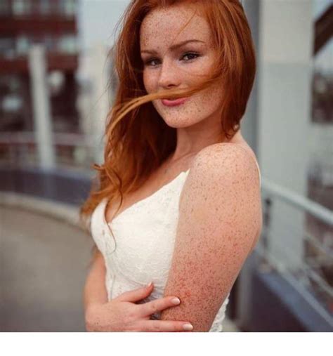 Nightly Sexiness – Freckles Edition 32 Pictures Funny Pictures