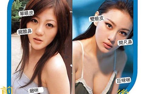 Zhang Yu Xi Plastic Surgery Before And After