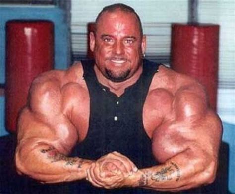 injecting synthol  wrong  pictures memolition