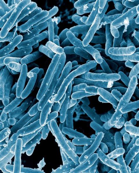 nih awards contracts  advance tuberculosis immunology research