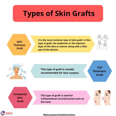 types  skin grafts