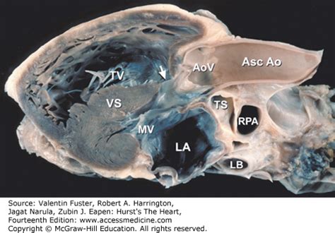 Functional Anatomy Of The Heart Hurst S The Heart 14e