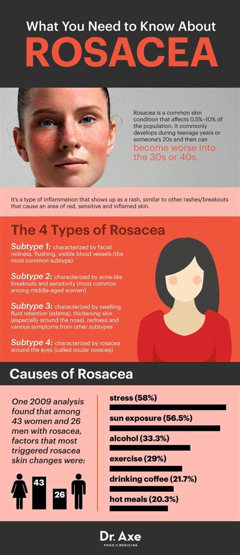 rosacea treatment 6 natural remedies to use in 2018 z info fyi pinterest