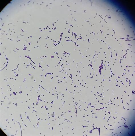 16 Best Gram Stains Of Bacteria Images On Pinterest