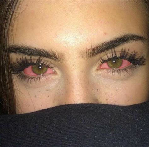 essa garota com cara de drogada está mostrando os seus olhos avermelhados e tampando a boca dela
