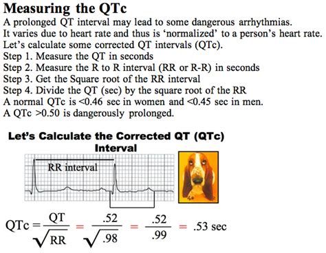 qt interval corrected measurement