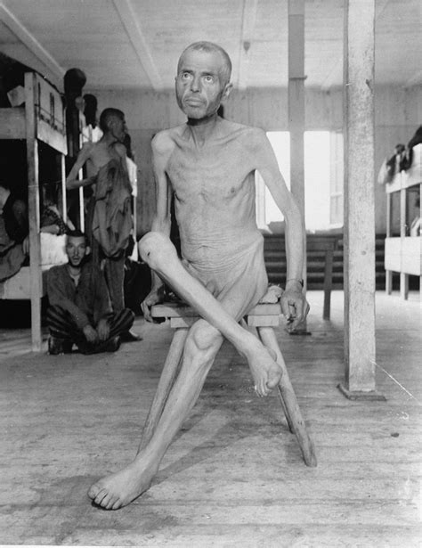 an emaciated hungarian jewish survivor sits on a stool in the infirmary