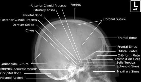 lateral view medical radiography radiology imaging radiology schools