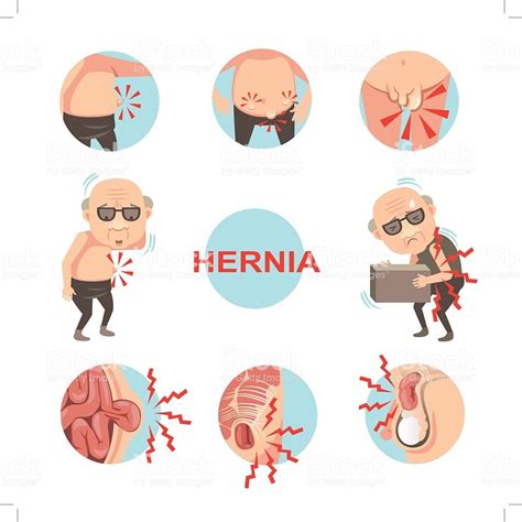 hernia ilustracao de hernia  mais banco de imagens de hernia royalty  elbow pain knee pain