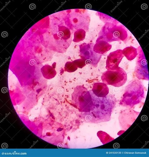 Bacteria Cell Gram Neagative Bacilli With Capsule Sample Sputum In Gram