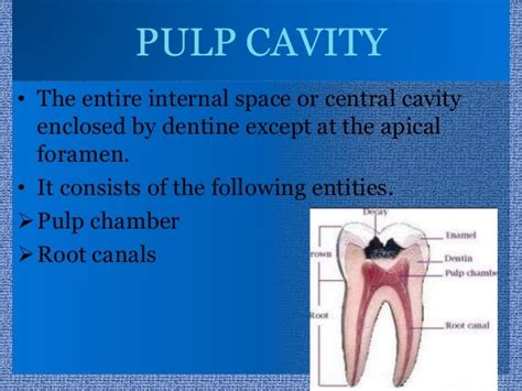 anatomy  pulp cavity  maxillary teeth