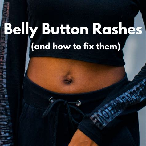 red rash  belly button