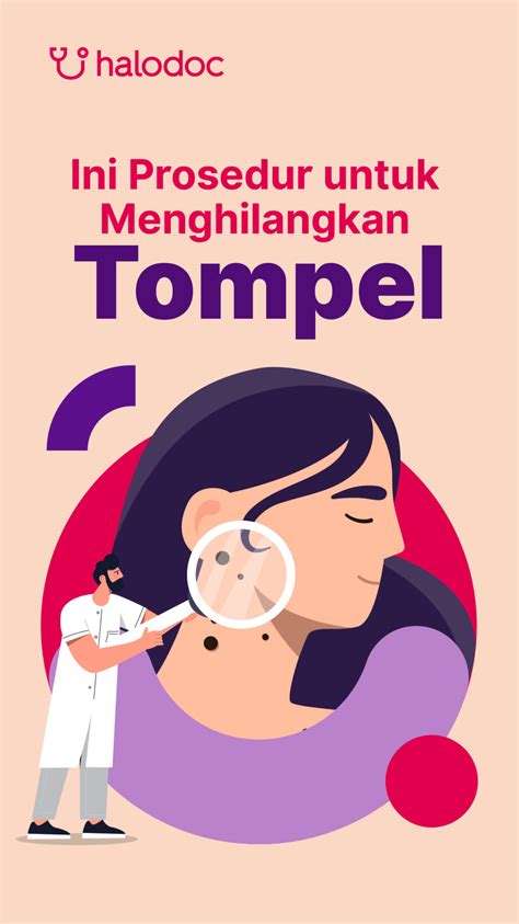 prosedur  menghilangkan tompel