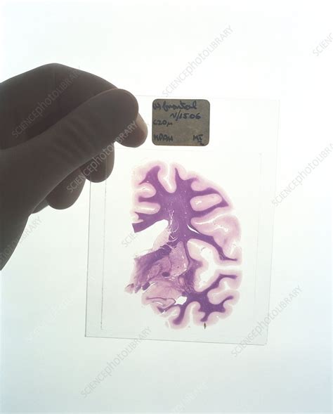 brain slice stock image p science photo library
