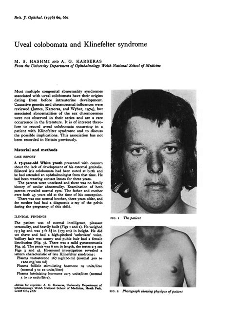 Uveal Colobomata And Klinefelter Syndrome British Journal Of