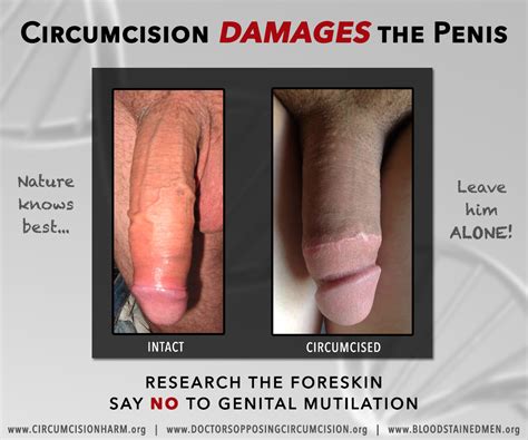 penis not circumsized sex nurse local