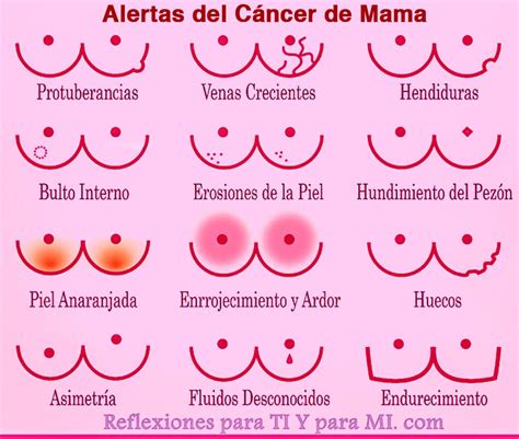 sintomas cancer de mama