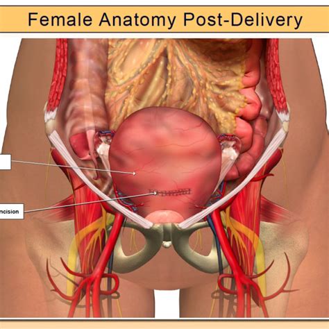Female Anatomy Post Delivery Trialexhibits Inc