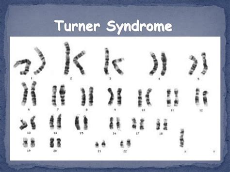 ppt pedigrees and karyotypes powerpoint presentation id 5830826