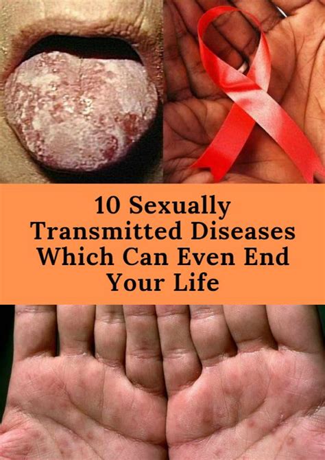 10 Sexually Transmitted Diseases Which Can Even End Your