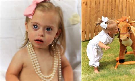 2 Year Old Girl With Down Syndrome Wins Two Modelling Contracts Thanks