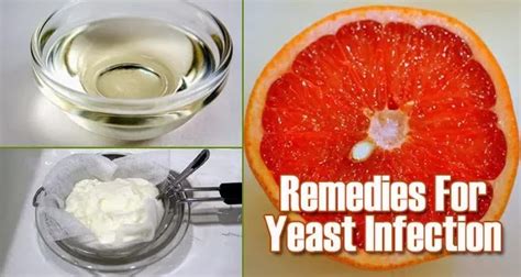 Top 5 Natural Remedies For Yeast Infection ~ Mzizi Mkavu