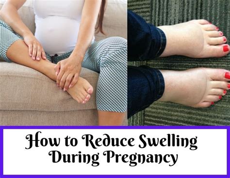 how to reduce swelling during pregnancy naturally theblessedmom