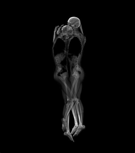 intimate x ray portraits of couples by ayako kanda and