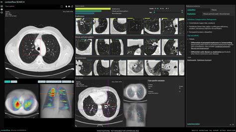 providing  efficient  image based search engine  radiology