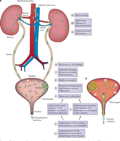 figure   urinary tract infections epidemiology mechanisms