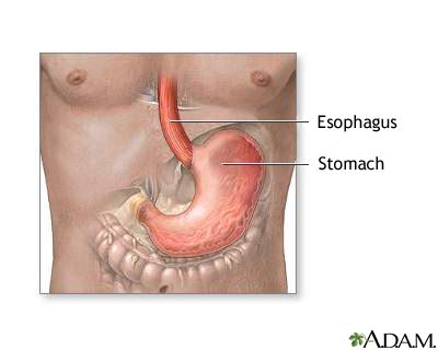 stomach  stomach lining medlineplus medical encyclopedia image