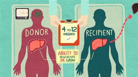 organ donation and liver transplantation youtube