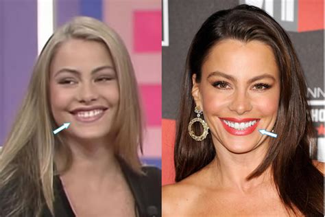 Has Sofia Vergara Had Plastic Surgery Before And After 2021