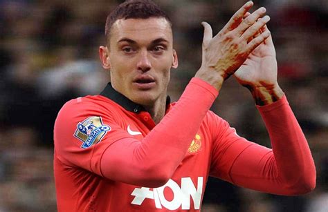 thomas vermaelen was dropped at arsenal so why are manchester united