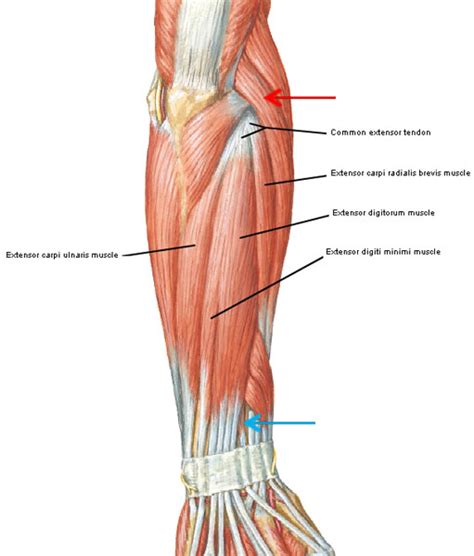 tendonitis    painful condition effecting  areas   body