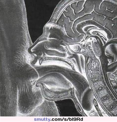 Positive Mri An Image By Openmind N Mouth Fantasti Cc Mri