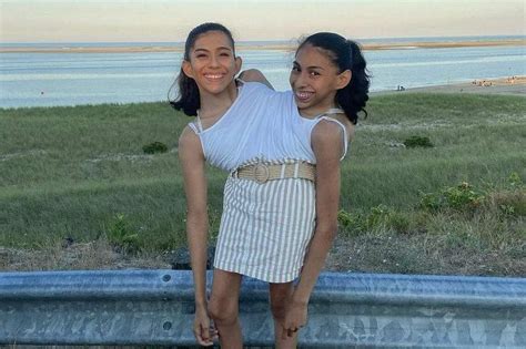 22 Year Old Us Conjoined Twin Sisters Drive Date And Focus On Living