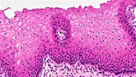 epithelial tissues stratified squamous epithelium flickr