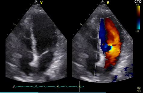 diagnostic ultrasound testing orlando heart vascular institute
