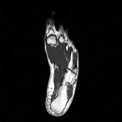 feet mri