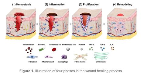 stages  healing  wound  pictures credihealth