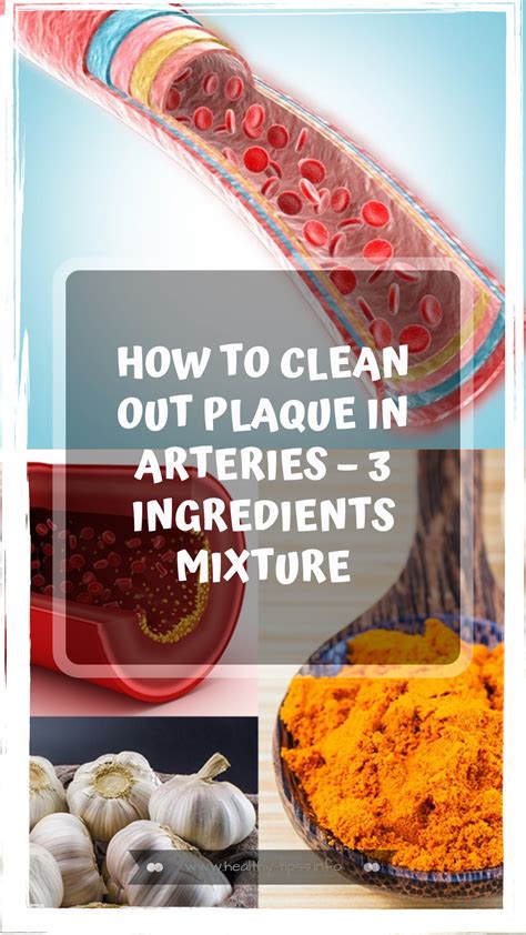 how to clean out plaque in arteries 3 ingredients mixture good